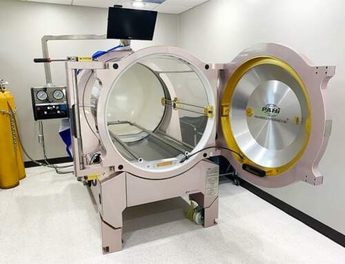 Lapeer, MI Stroke Treatment: Try Hyperbaric Oxygen Therapy